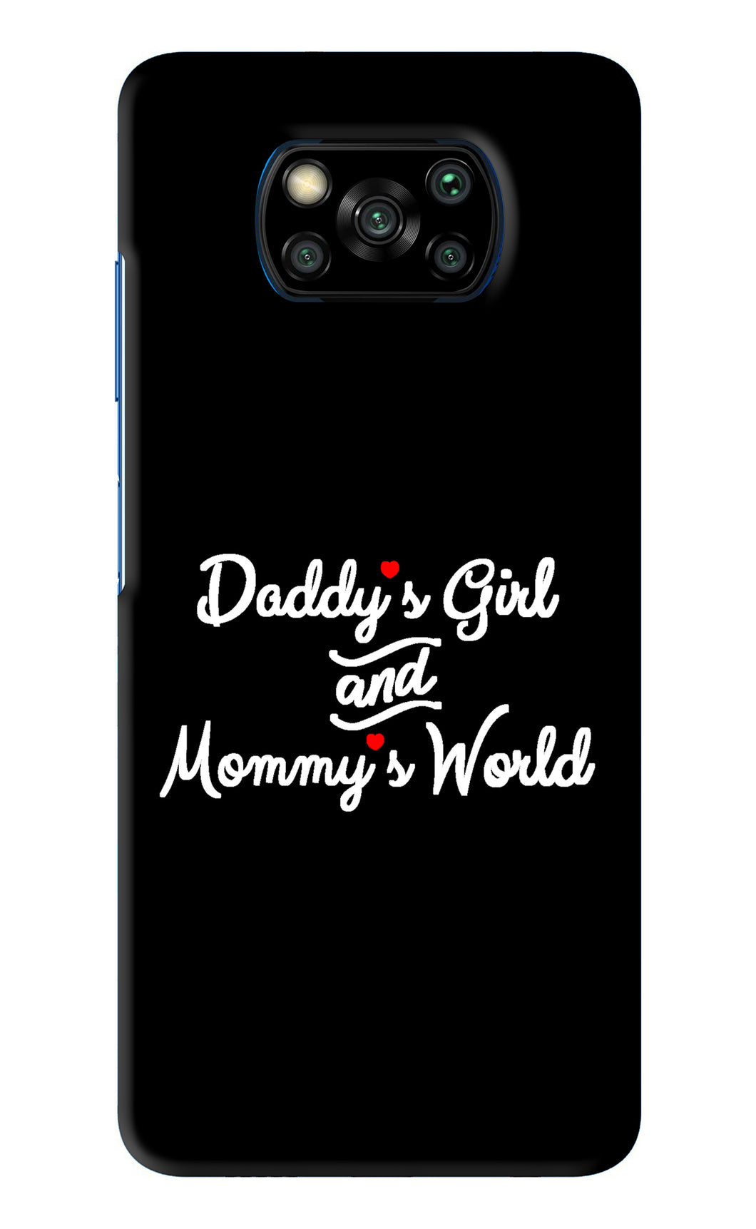 Daddy's Girl and Mommy's World Poco X3 Back Skin Wrap